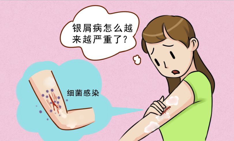 不治疗牛皮癣会有什么危害?